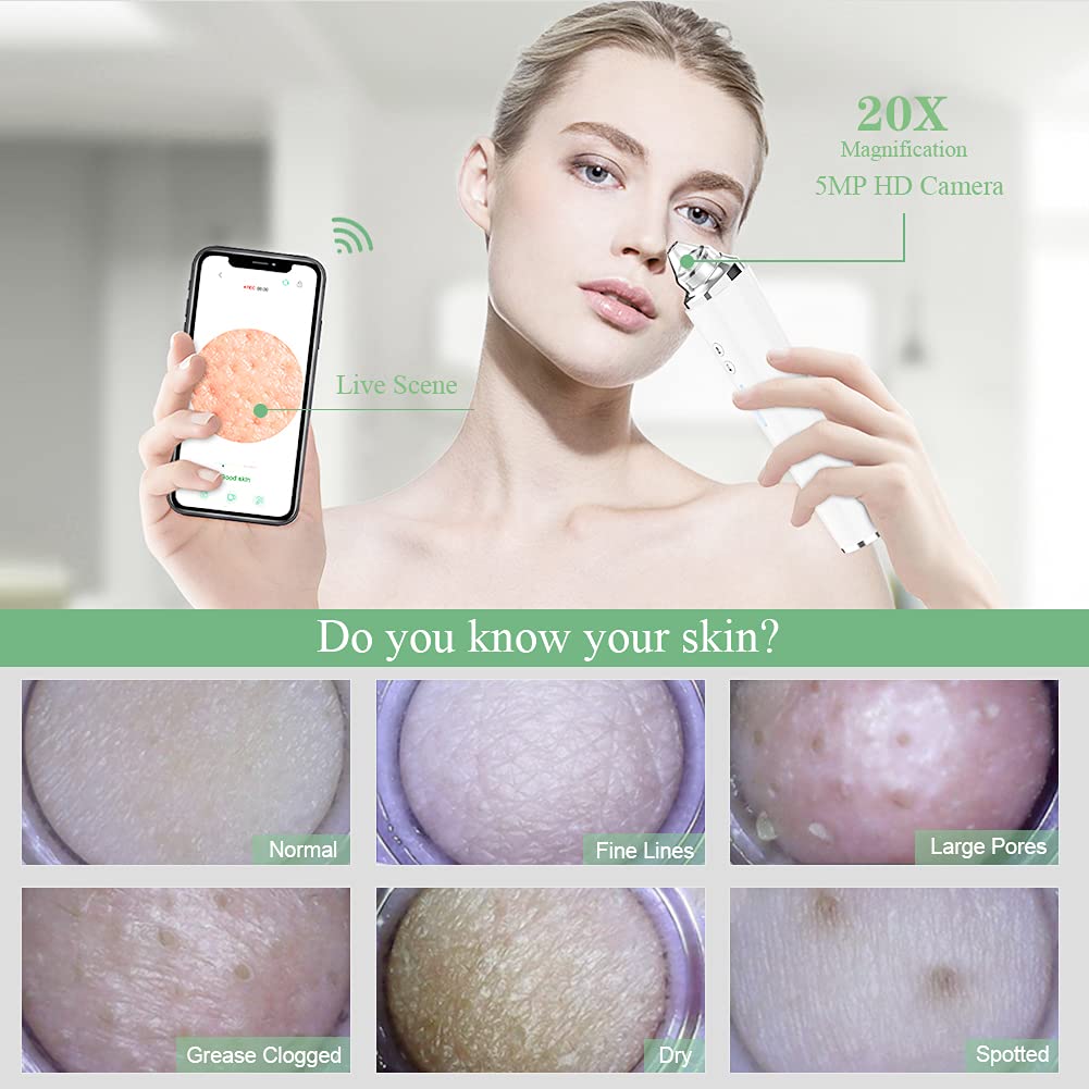 Blackhead Remover Pore Vacuum WiFi Visible Facial Pore Cleanser with HD Camera