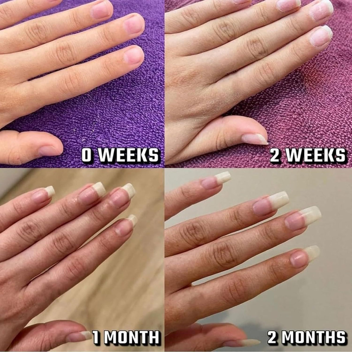 Rapid Nail Repair & Hydration