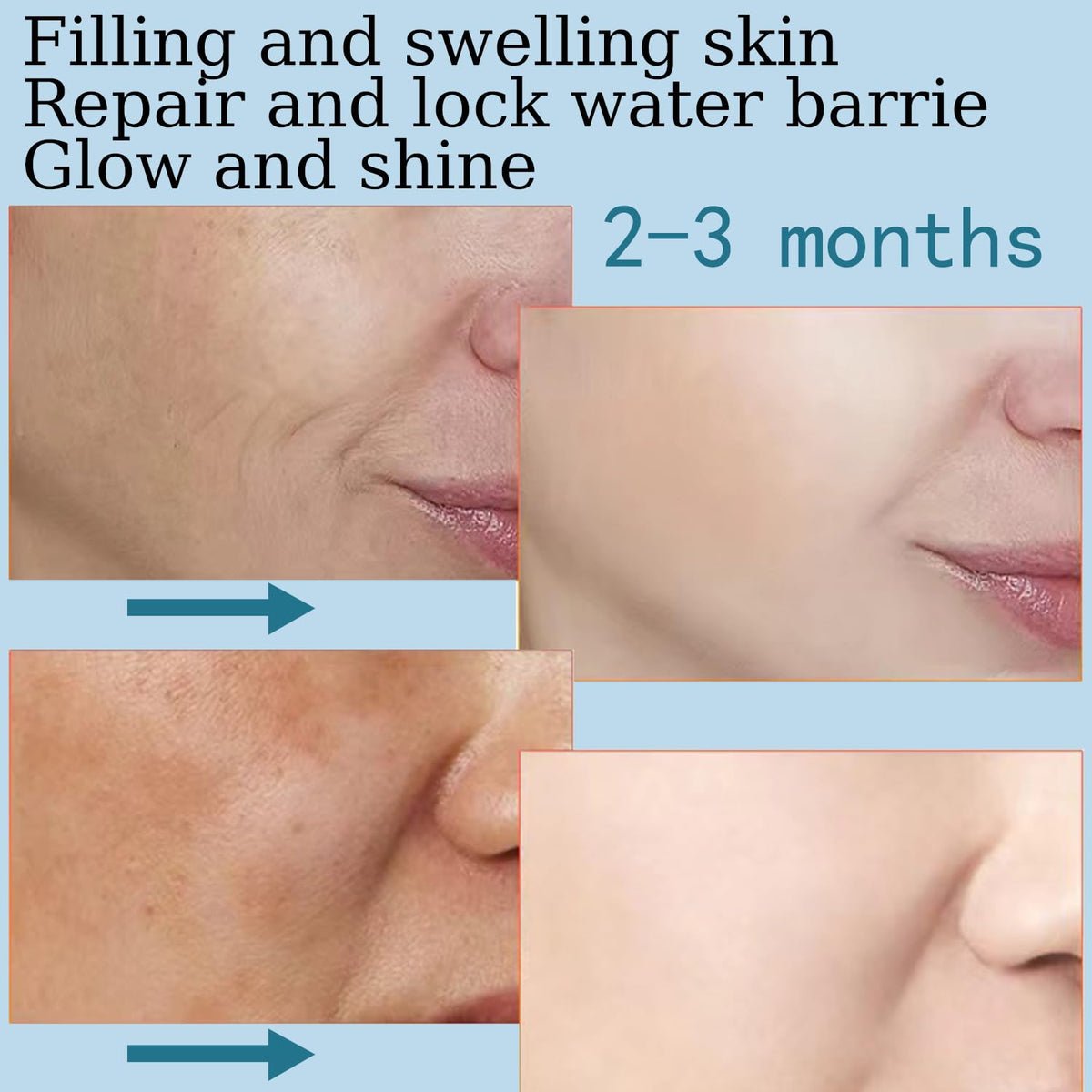 Hyaluronic Acid 5% + Vit E, Best Pure Hyaluronic Acid Moisturiser for Face, Anti Ageing & Anti Wrinkle Moisturiser Hyaluronic Acid Serum, Fine Lines & Sensitive Skin, Improve Age Spots（60ml）