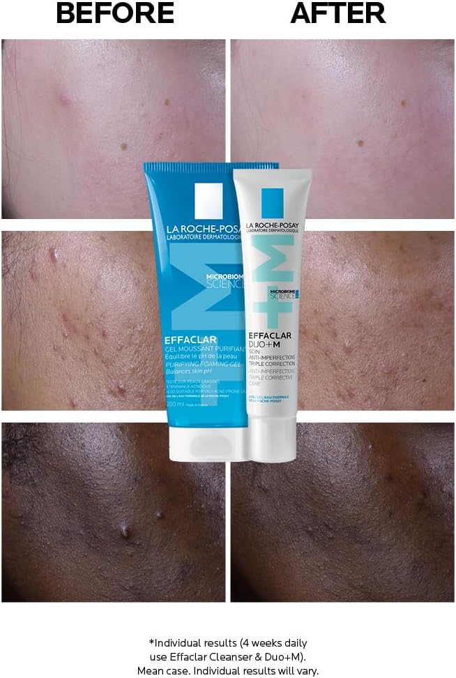 Anti-Breakout Corrective Gel 40ml