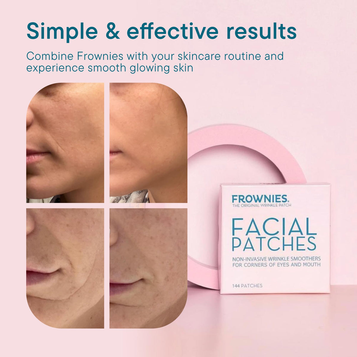 Frownies Anti-Wrinkle facial smoother Patches