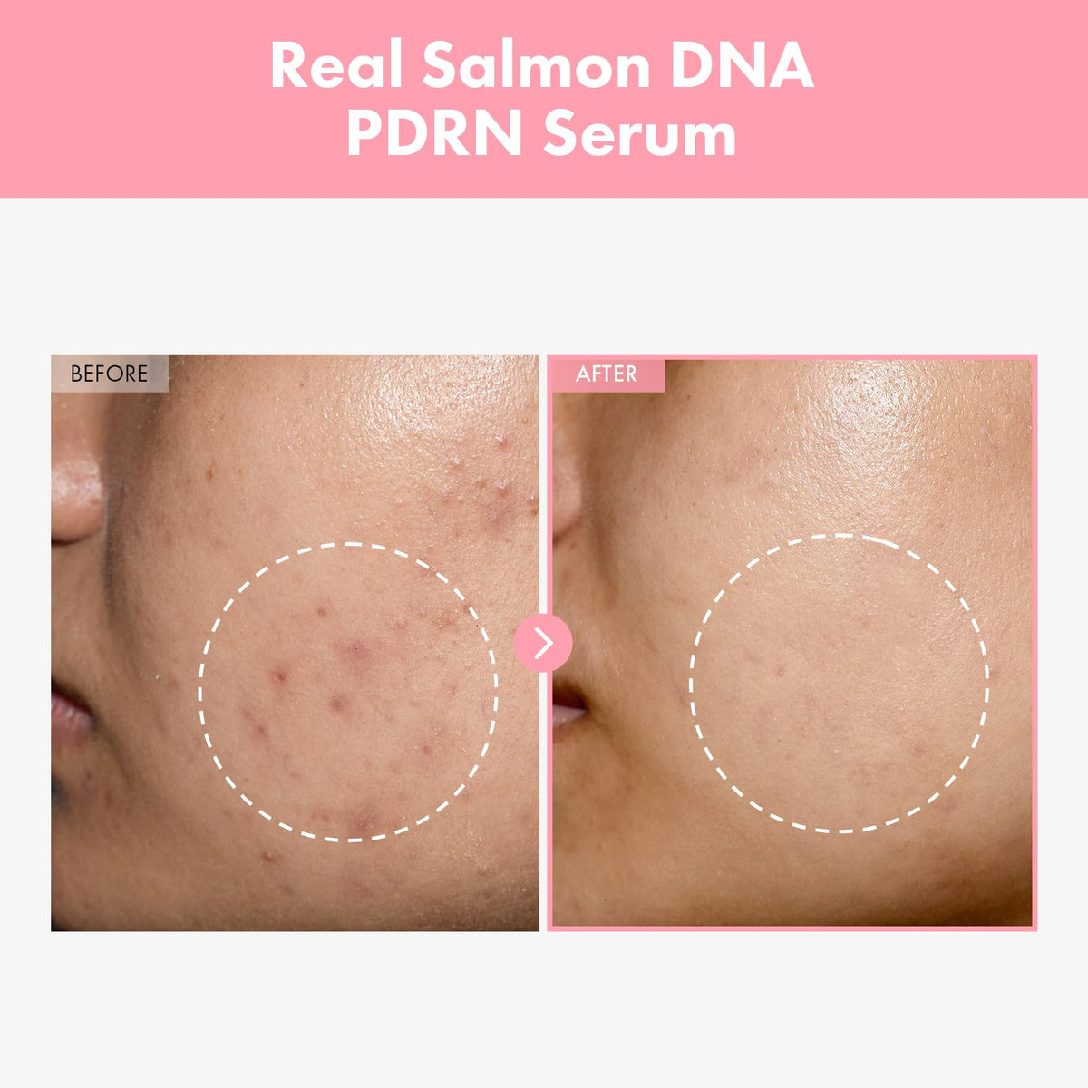 Pink Peptide 12 PDRN Serum With Salmon DNA PDRN 10,320ppm, 12 Peptides, Niacinamide, Skin glow