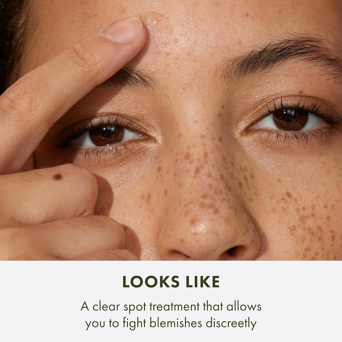 Blemish Spot Treatment with Salicylic Acid