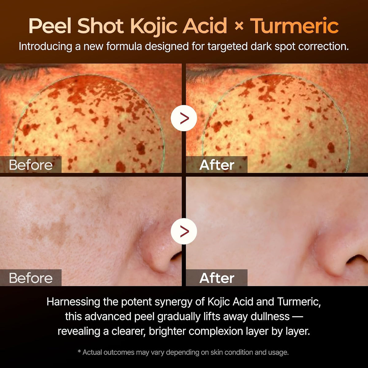 Dr.Melaxin Peel Shot - Kojic Acid Dark Spot Corrector